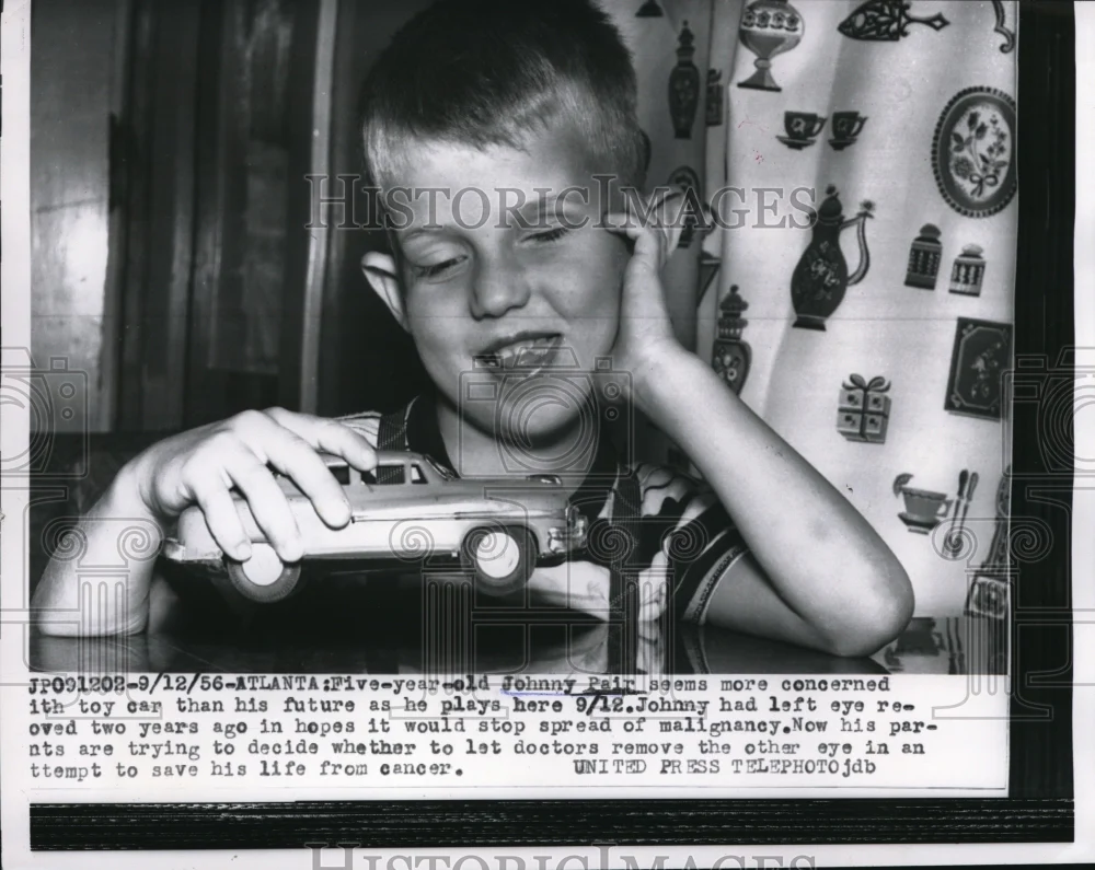 1956 Press Photo Johnny Pair Eye Cancer Victim removed eyes to save his life