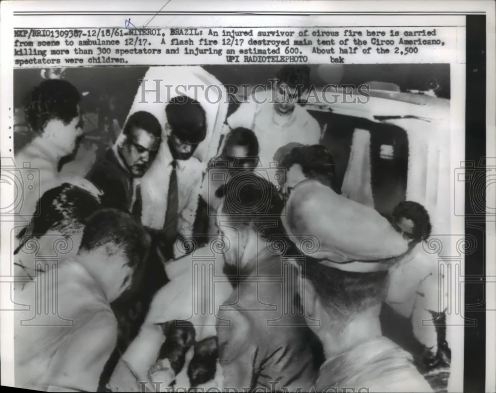 1961 Press Photo Injured Survivor of A Circus Fire - ned54082