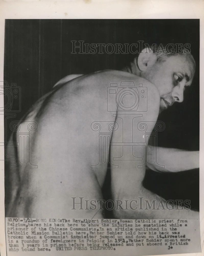 1955 Press Photo Rev.Albert Sohier injuries white prisoners of Chinese Communist