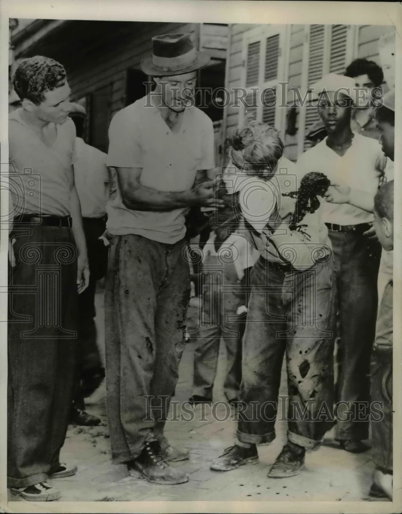 1938 Press Photo Arthur Piccla, casualty of clash between CIO and AFL teamsters.