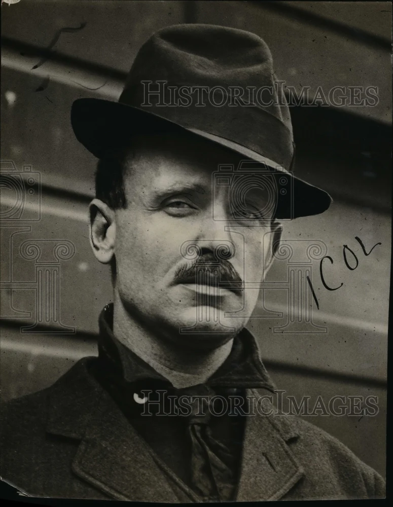 1923 Press Photo Doctor RM Anderson - nex27891