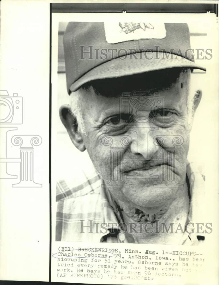 1973 Press Photo Charles Osborne of Iowa has been hiccuping for 51 years.